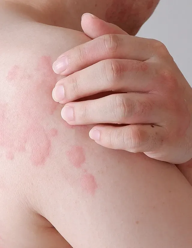 b12 is still low with injections Vitamin B12 Injections: What You Need To Know